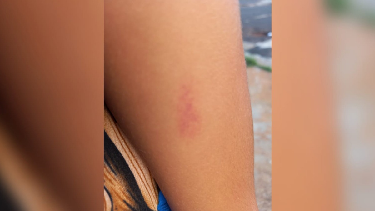 Prefeitura abre sindicância sobre denúncia de agressão em escola 1